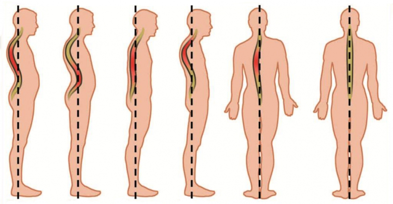 <span style="color: rgb(31, 31, 31);">Мануальные терапевты</span>